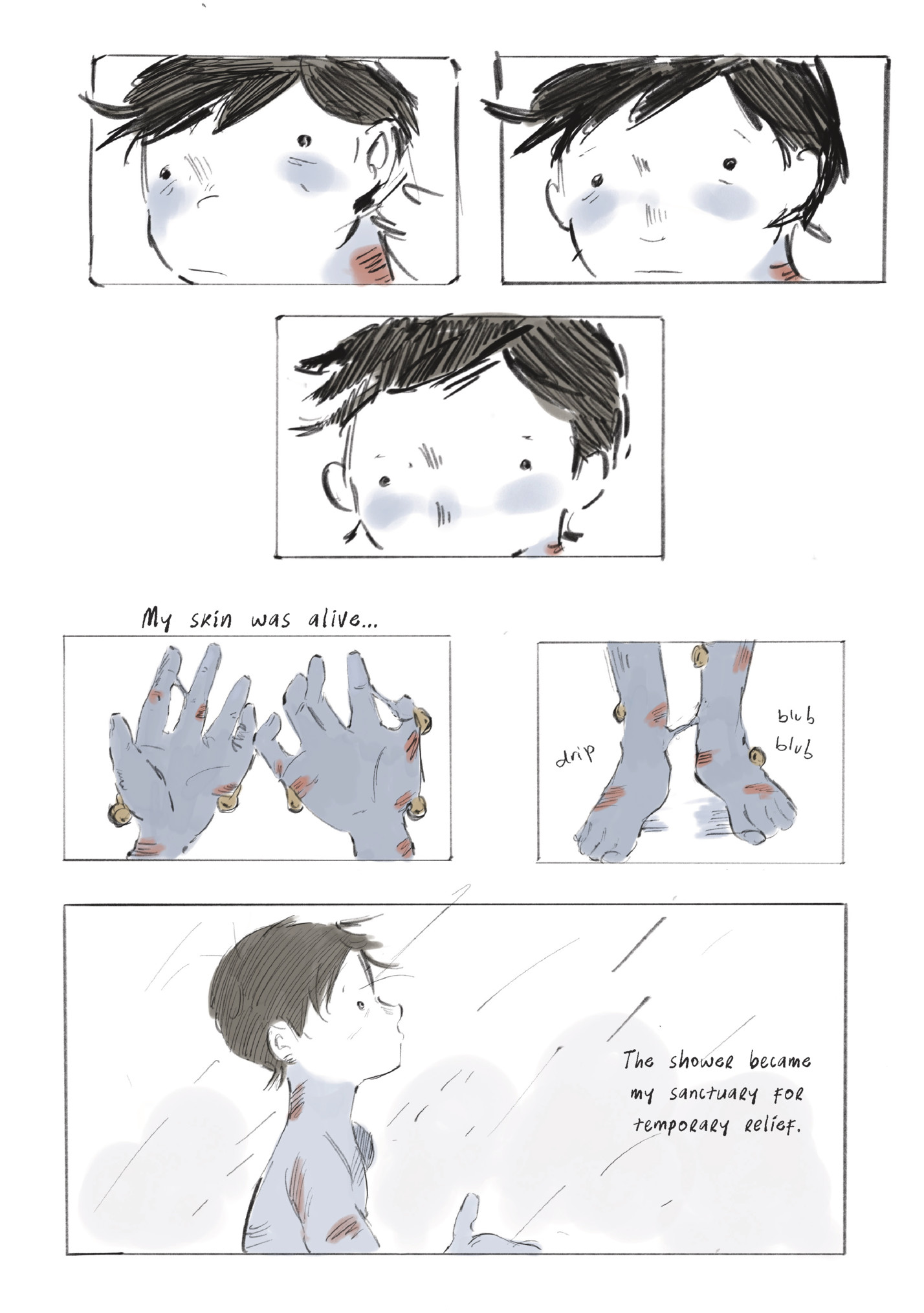 My skin was alive...