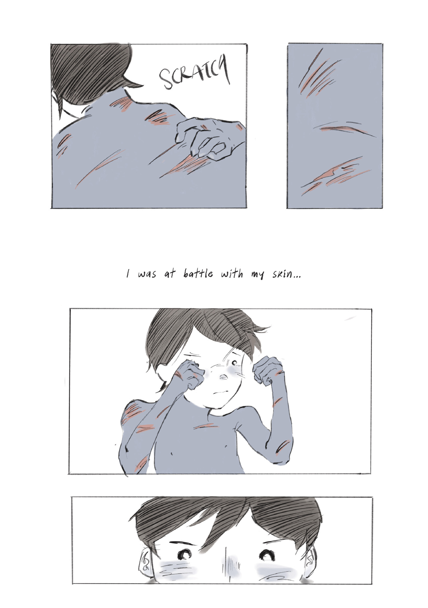 I was at battle with my skin...