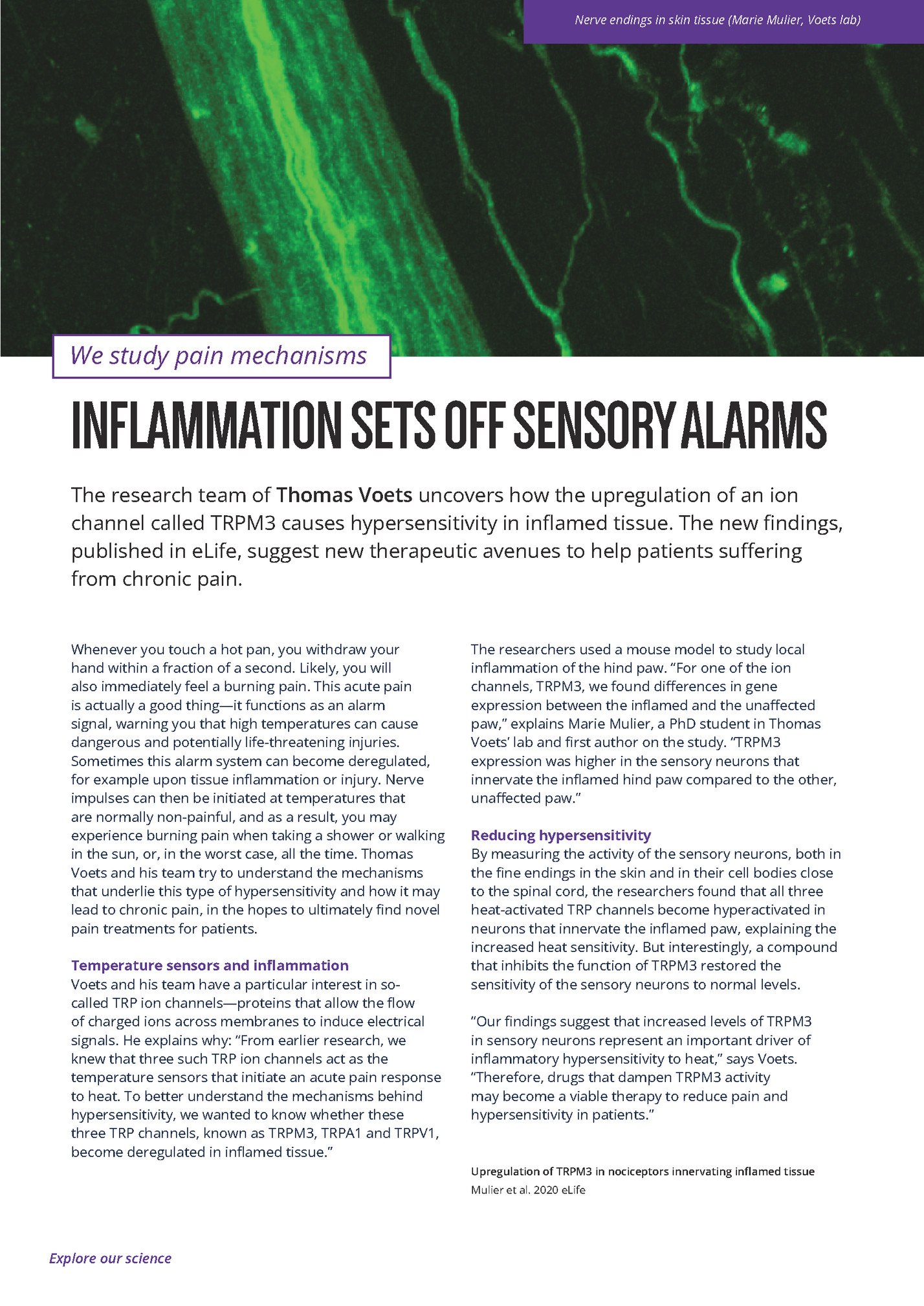 Nerve endings in skin tissue (Marie Mulier, Voets lab)