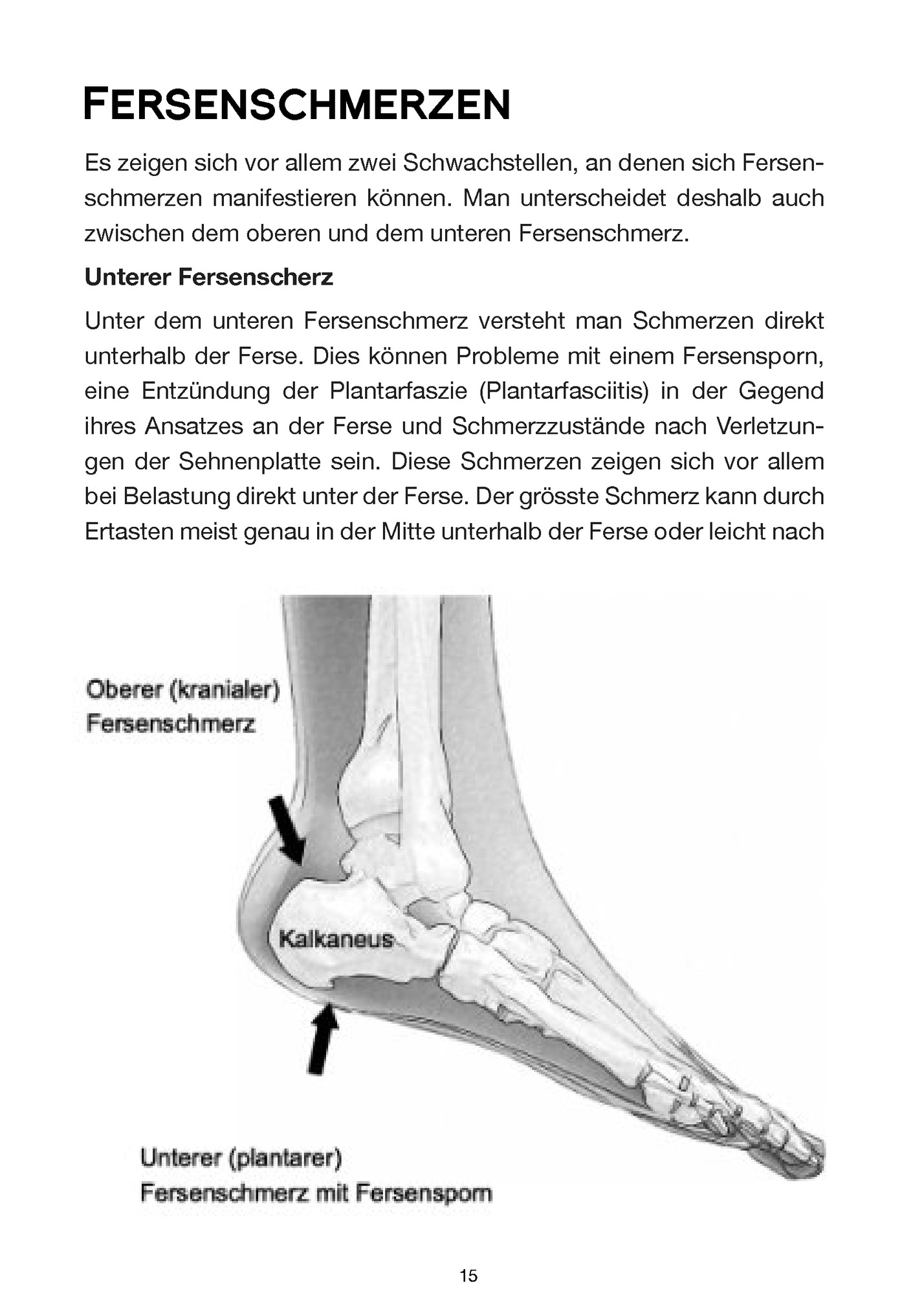 Es zeigen sich vor allem zwei Schwachstellen, an denen sich Fersen‐