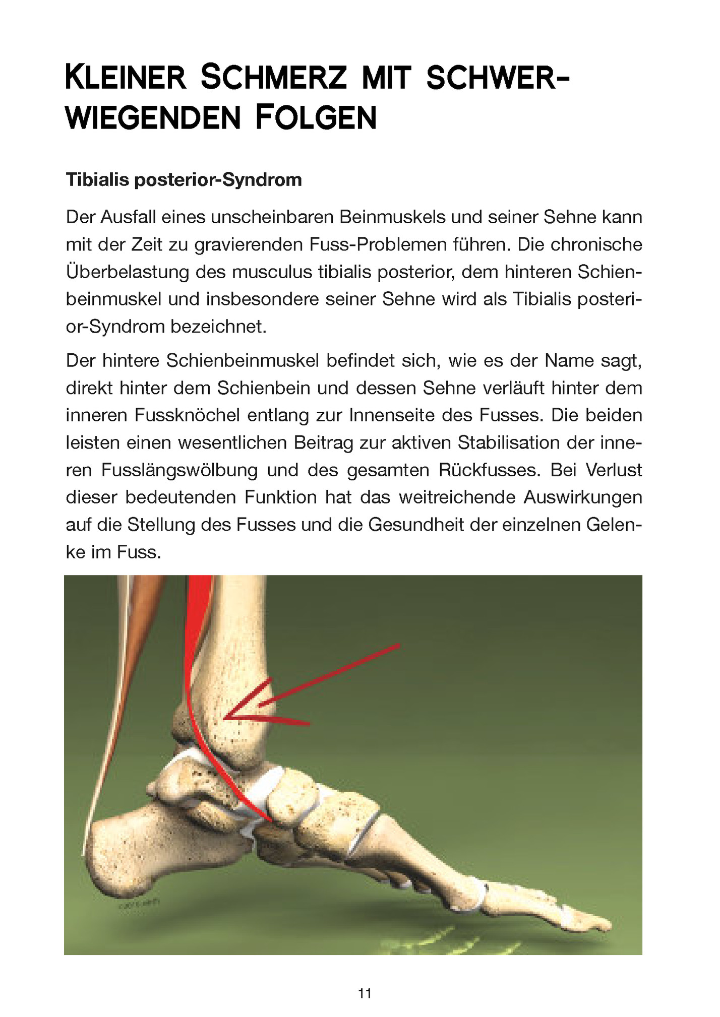 Kleiner Schmerz mit schwerwiegenden Folgen