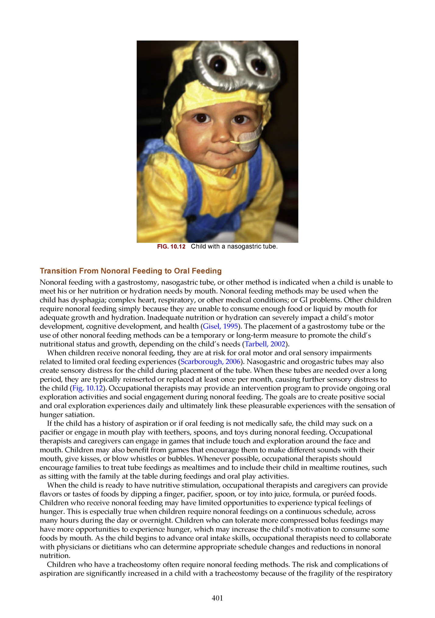 FIG. 10.12 Child with a nasogastric tube.