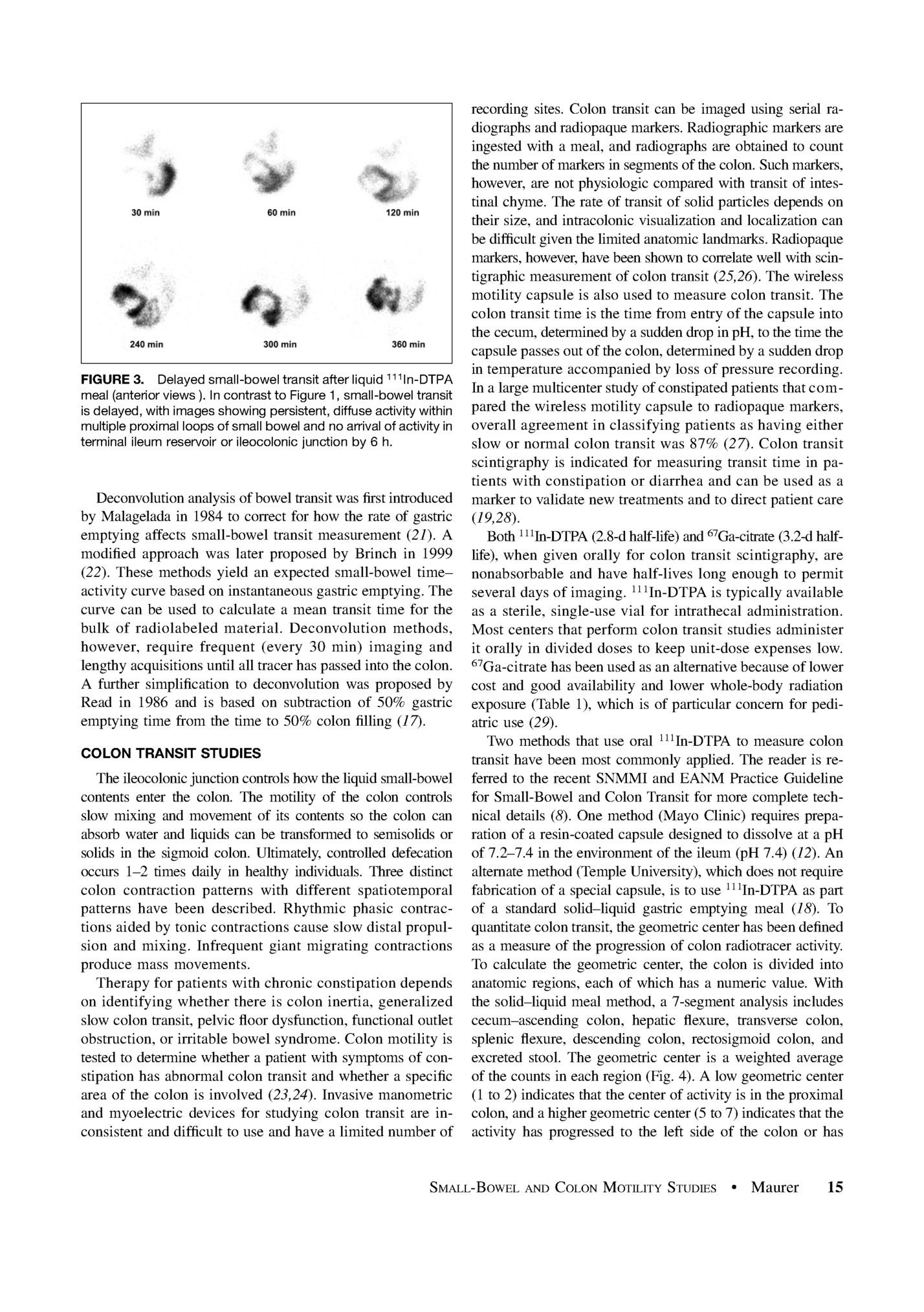 FIGURE 3. Delayed small-bowel transit after liquid 111In-DTPA